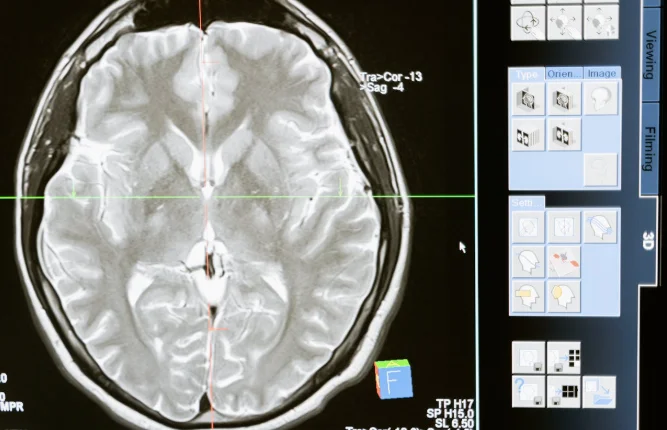 Preventive healthcare in 2026 early disease detection using AI and modern medical technology